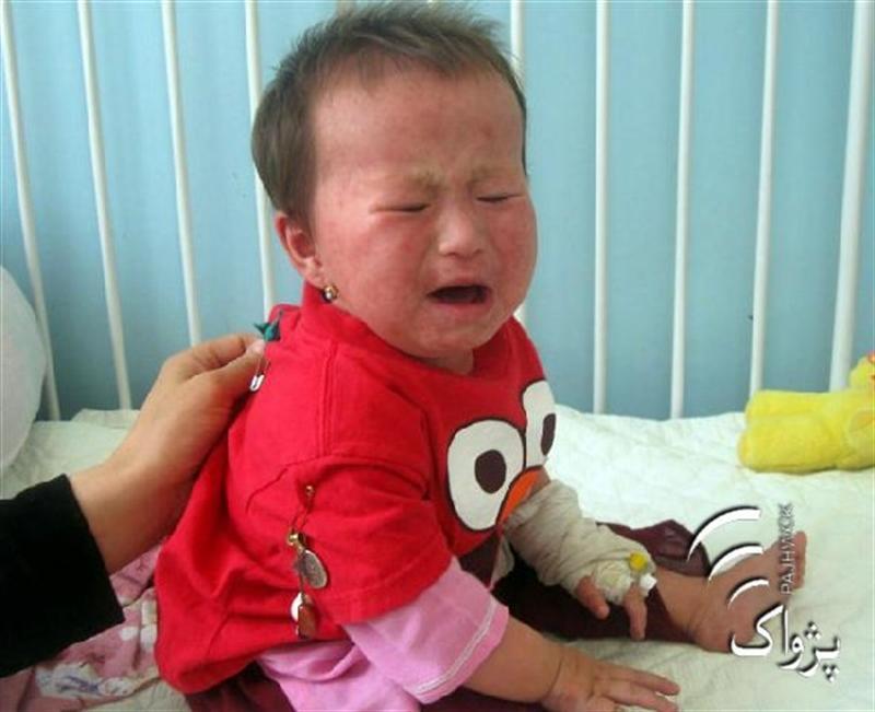 ۶۳ کودک مبتلا به بيمارى هاى سرخگان و سينه- بغل در غورجان داده اند