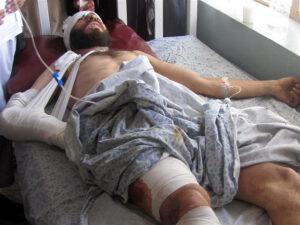 انفجار ماین درولسوالى غورماچ ٣کشته و١٨مجروح برجا گذاشت