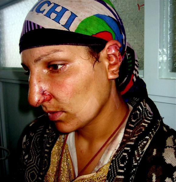 په زابل کې ښځې له ګڼو ستونزو سره مخ دي