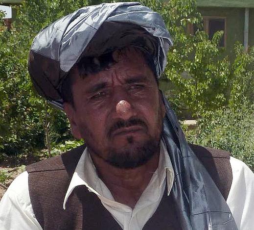 د شاه جوى ولسوال له چاودنې روغ ووت