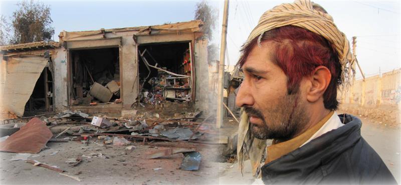 Pajhwok cameraman among 7 injured in Jalalabad blasts