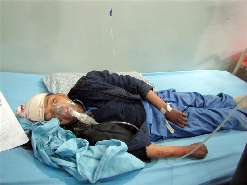 Orphaned children among 18 injured in Jalalabad blast