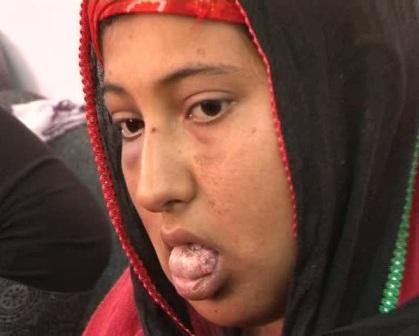Call to probe physical violence on Balkh girl