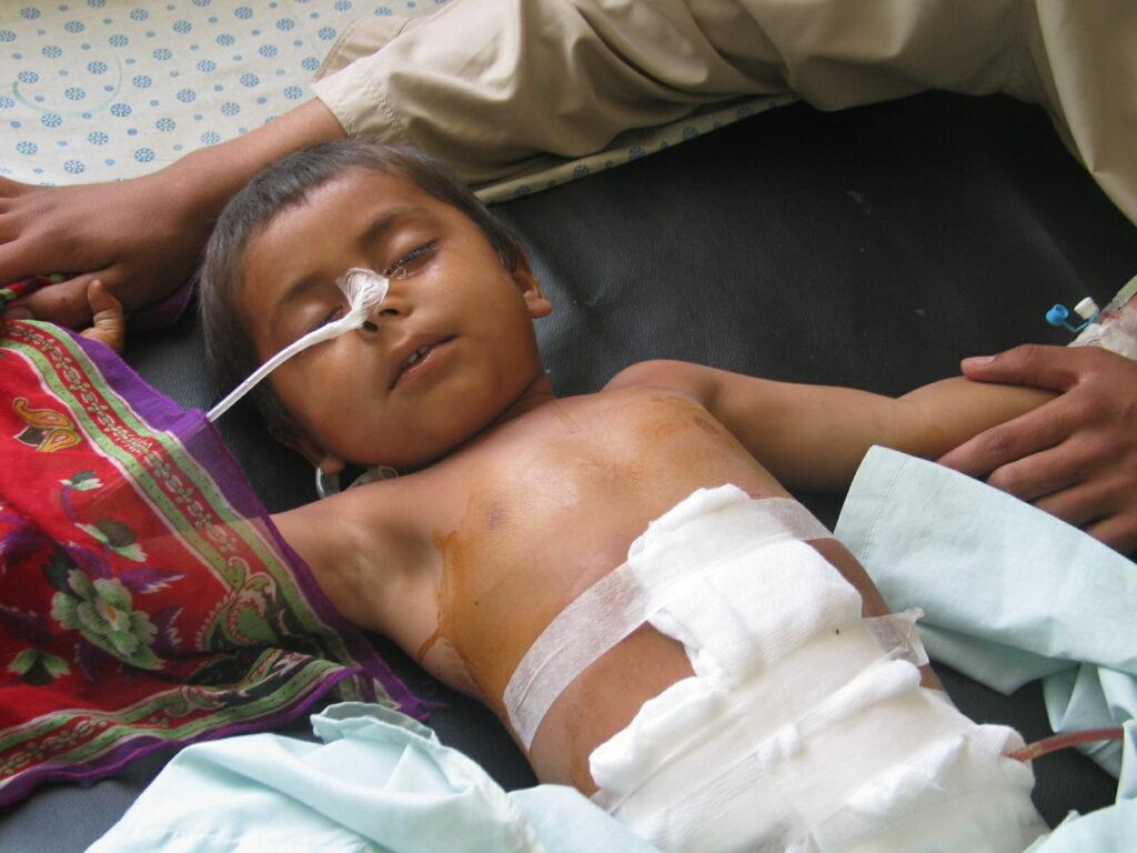 د ننګرهار په ملکي روغتون کې د برق شارټۍ څلور ماشومان مړه کړي