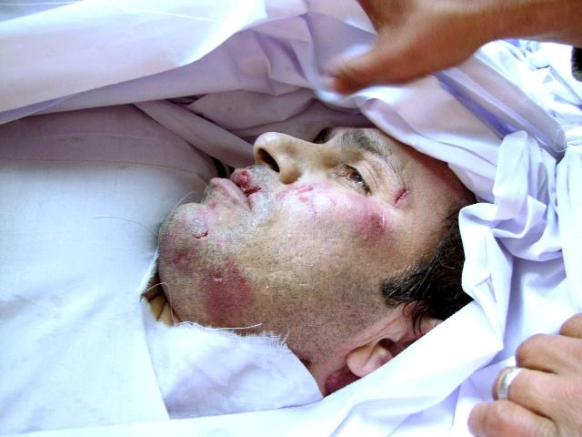 Actor kills in Jalalabad
