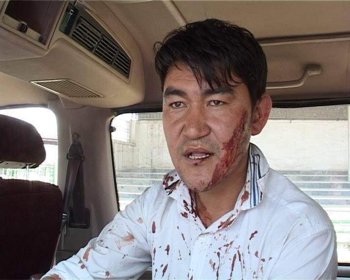 Beating of reporter condemned