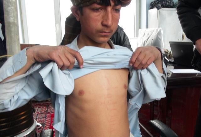 غزني کې د يوه هلک پر سينه ” کلمۀ طيبه ” څرګنده شوې