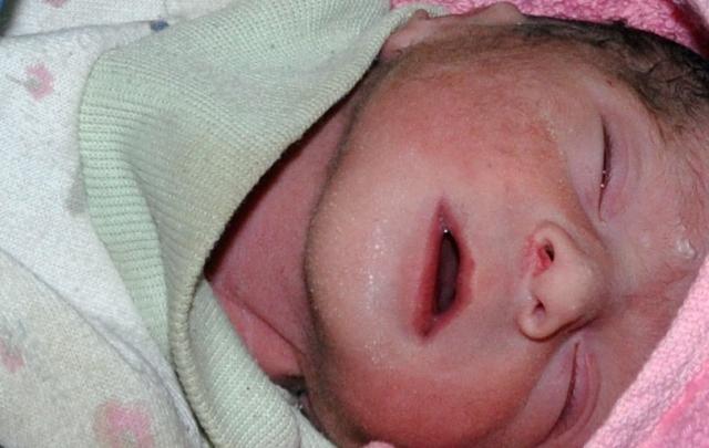 12 newborns die of sepsis in Panjsher hospital
