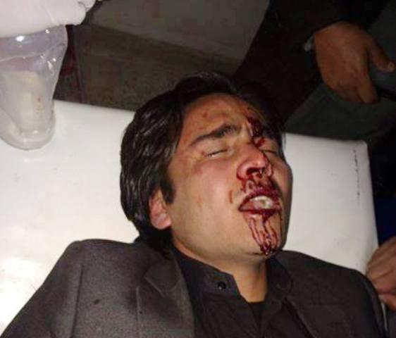 Journalist injured, beaten unconscious in Balkh