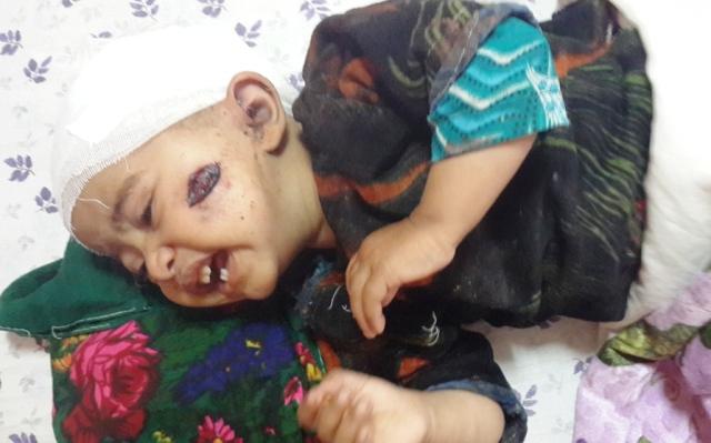 در لغمان به شمول اطفال پنج فرد ملکى مجروح شدند
