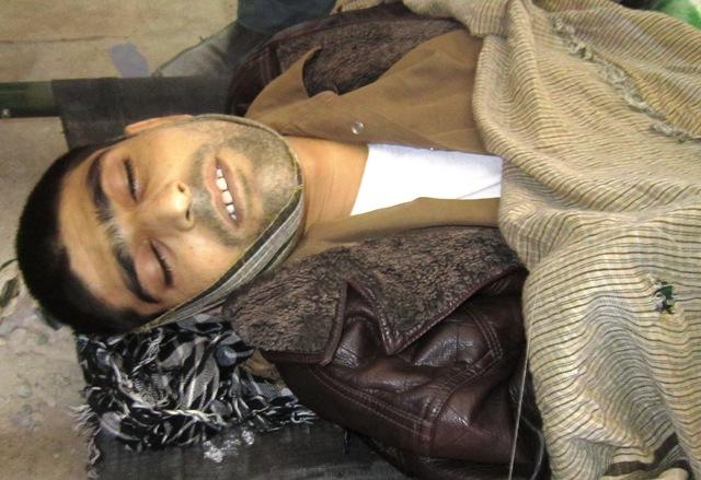 يک زندانى بخاطر عدم تداوى در نيمروز جان باخت