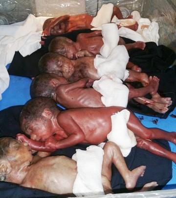 Herat woman gives birth to sextuplets