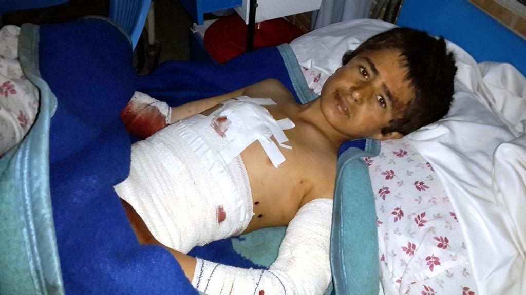 انفجار ماین در هرات چهار فرد ملکی را زخمی ساخت