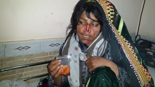 Faryab man chops off wife’s nose, prompting calls for justice