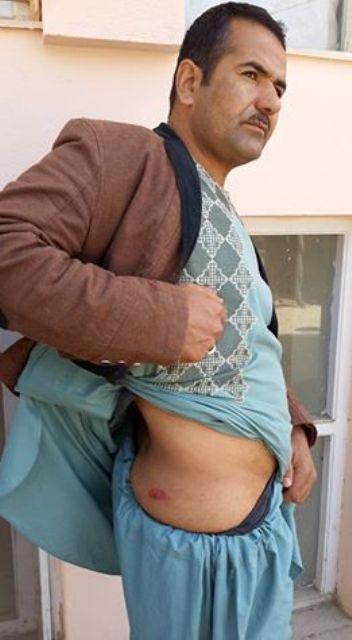 Pajhwok reporter beaten up by Faryab security personnel