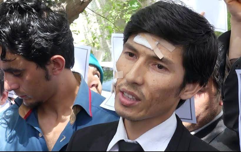 Balkh MP’s guards beat, threaten to death journalist