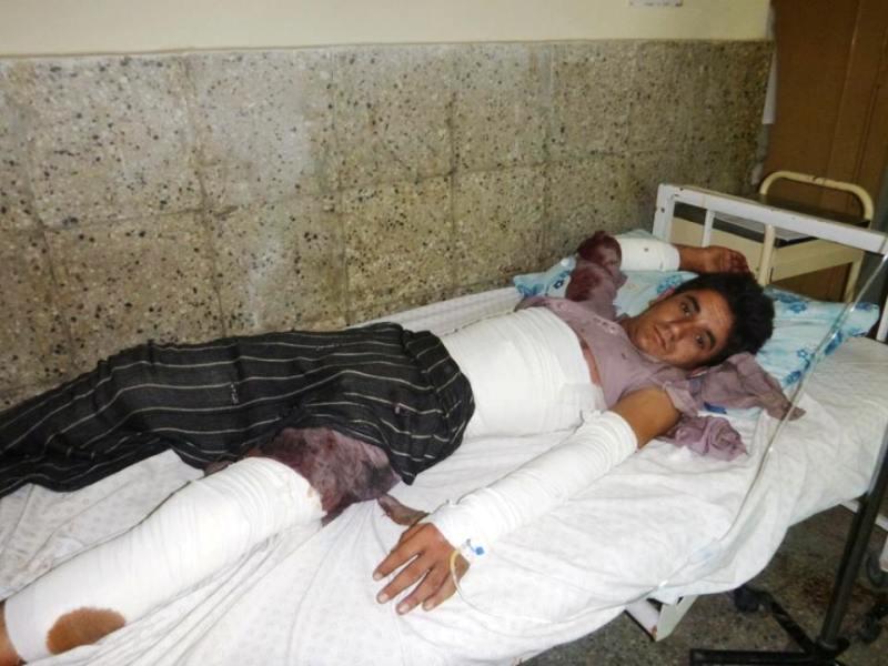 10 civilian injured in Asadabad blast
