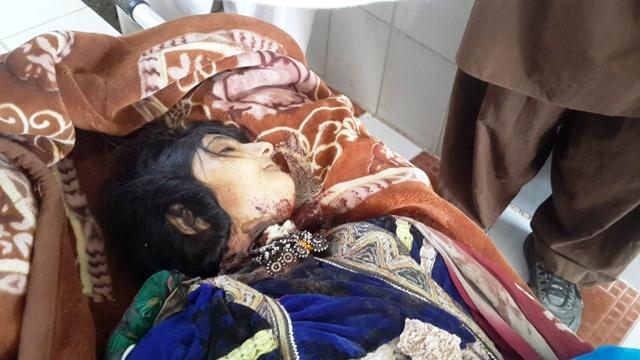 Young woman from Badghis decapitated by in-laws