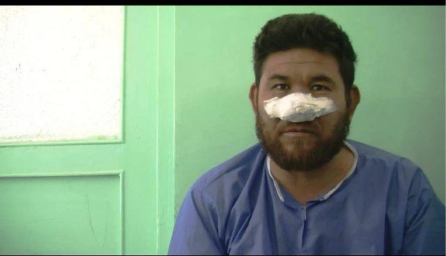 بيمارى تب کنگو در افغانستان در حال افزايش است