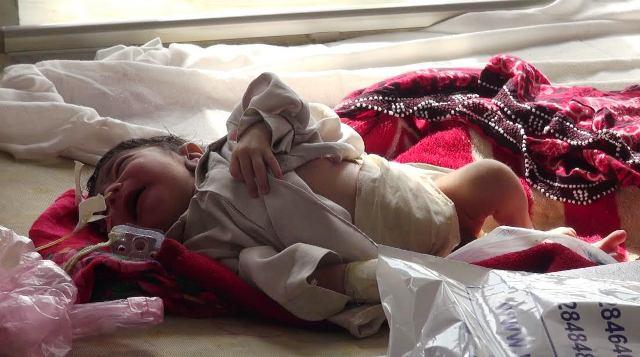 Children’s seasonal diseases on the rise in Balkh