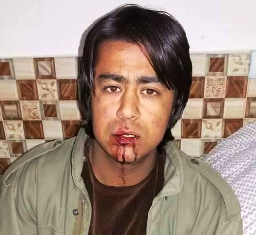 Ghazni police beat, harass TV journalist
