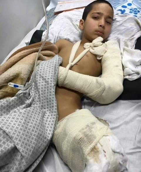 Mortar crushed Kunduz boy’s leg and his dreams