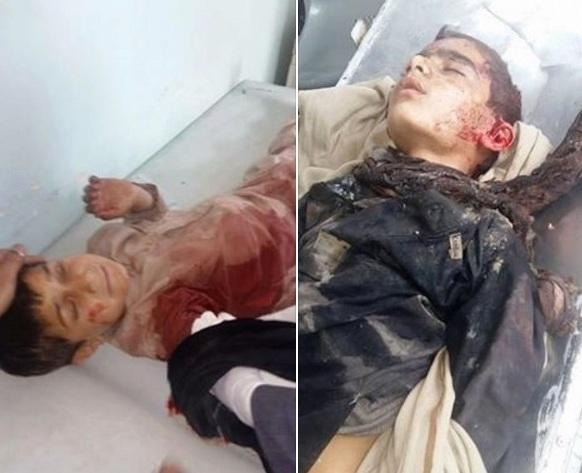 Daesh-planted bomb wounds 11 schoolchildren