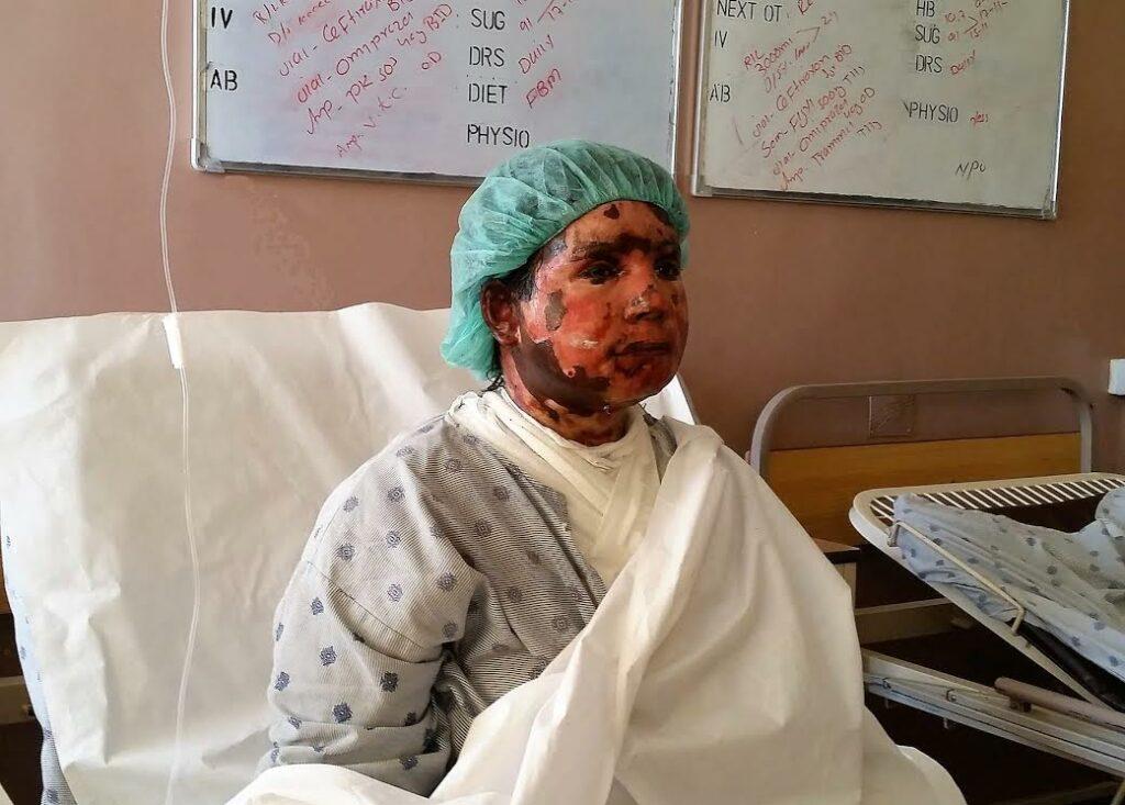 Woman poured oil, set ablaze in Kandahar