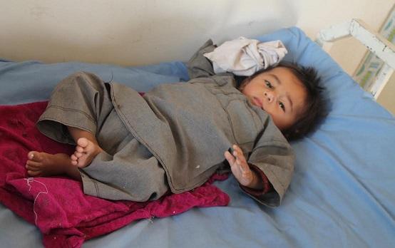 Diarrhea cases among children rising in Sar-i-Pul