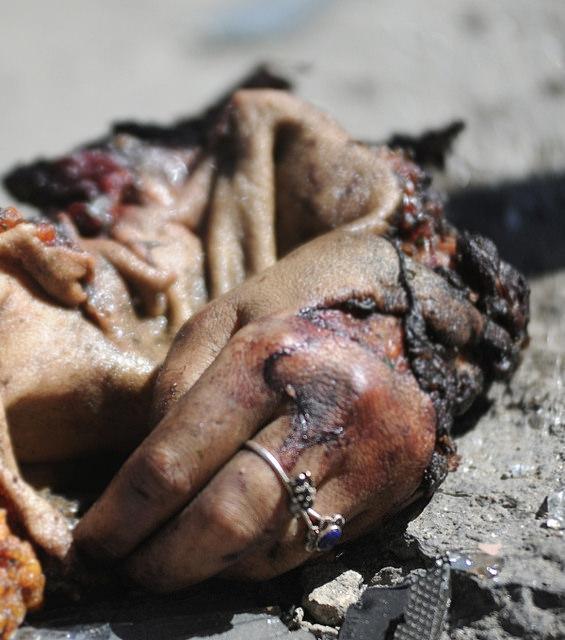 Burnt hand of a Killed Woman