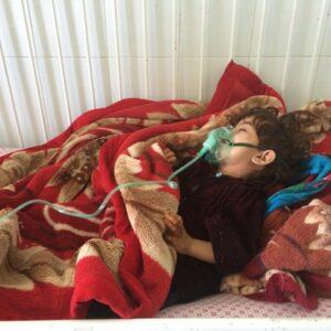 2 Paktika children die of a mysterious disease