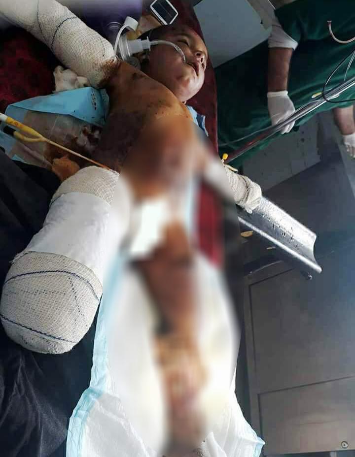 سه طفل در اثر انفجار ماين در ارزگان کشته شدند