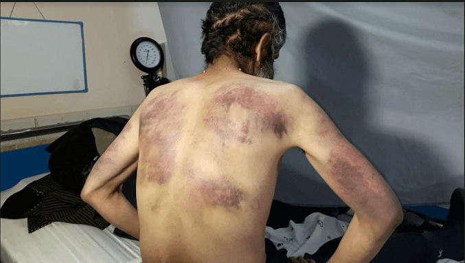 ادعاى یک معلول: با پرداخت ٥٠ هزار افغانی ازقيد يک قوماندان طالبان آزاد شدم