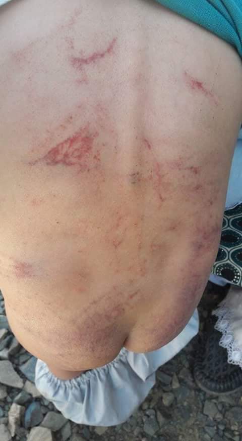 مسئولان دردايکندى:قضيه لت و کوب کودک دوسال توسط پدرش بررسى مى شود