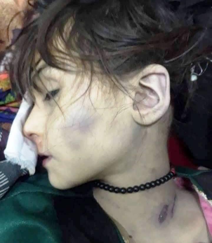 دختر ٨ سالۀ نامزادشده در ولسوالی قادس بادغیس کشته شده است