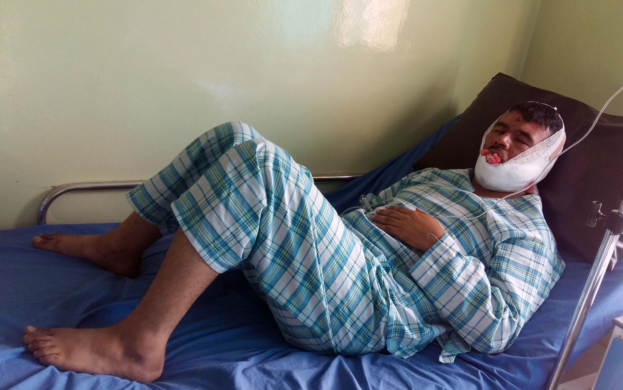 Injured security man in Samangan