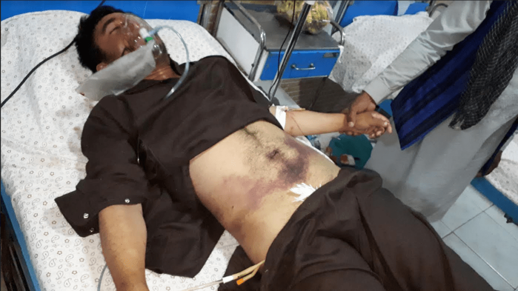 منابع : یک جوان از اثر لت وکوب طالبان جان باخت