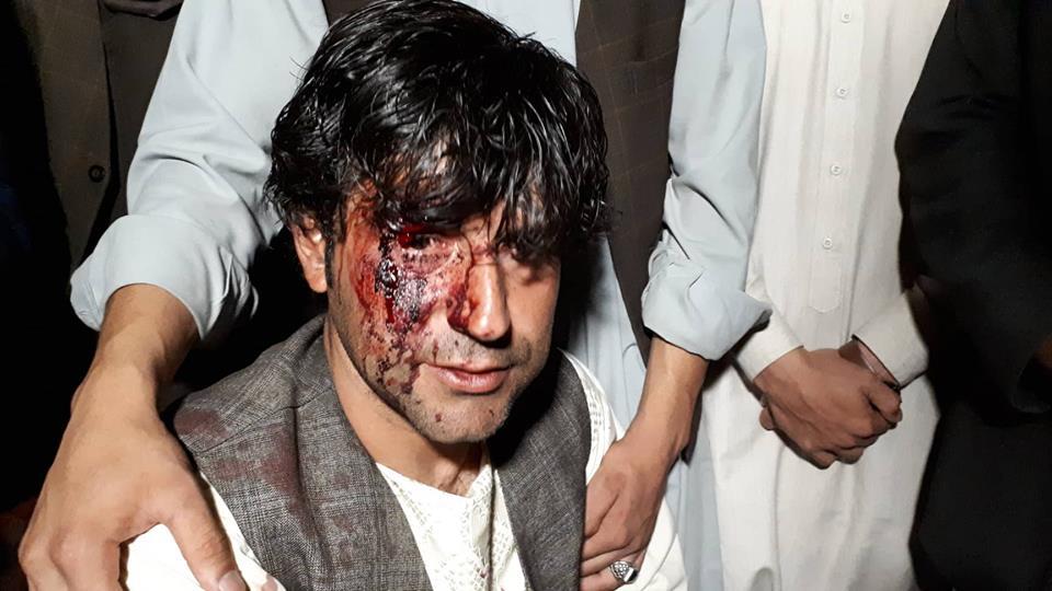 5 NDS personnel held after beating TV cameraman in Faryab