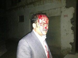 Senior Balkh civil society activist survives bid on life