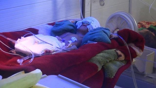Newborn dies in Baghlan hospital due to no oxygen