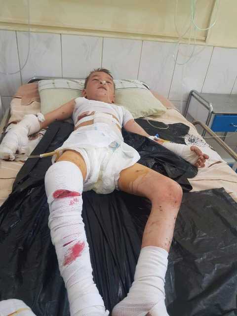 انفجار ماین در فارياب یک طفل را کُشت و سه تن را زخمی ساخت