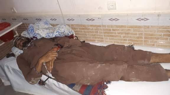 اصابت راکت در شهر میمنه سه تن را زخمی کرد