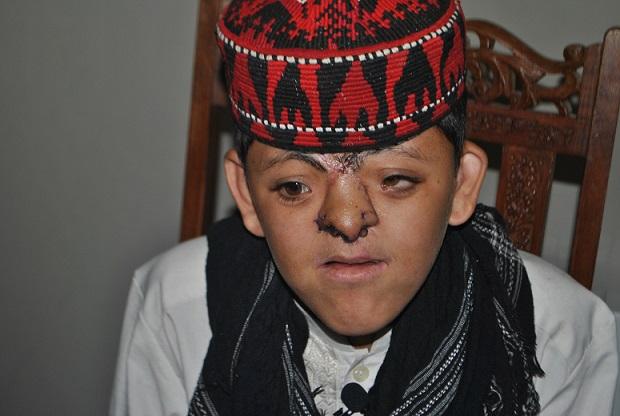Afghan surgeon conducts successful nose surgery