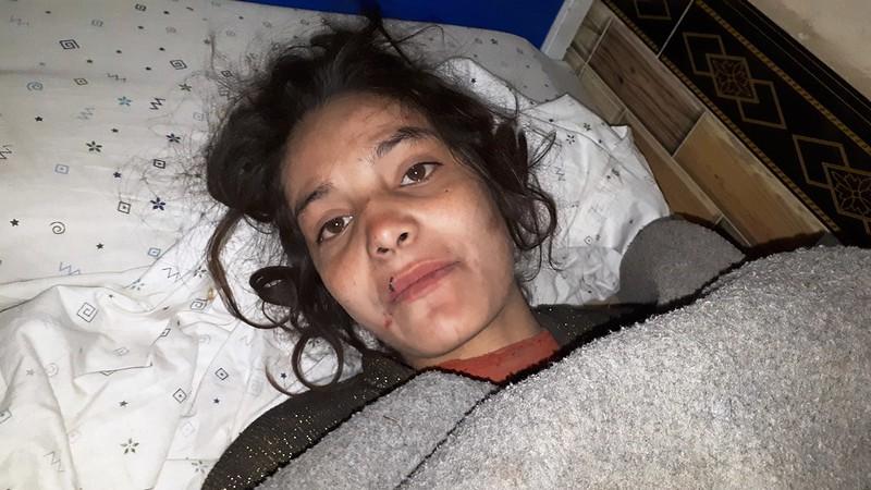 Tortured for months, married Faryab girl may lose legs