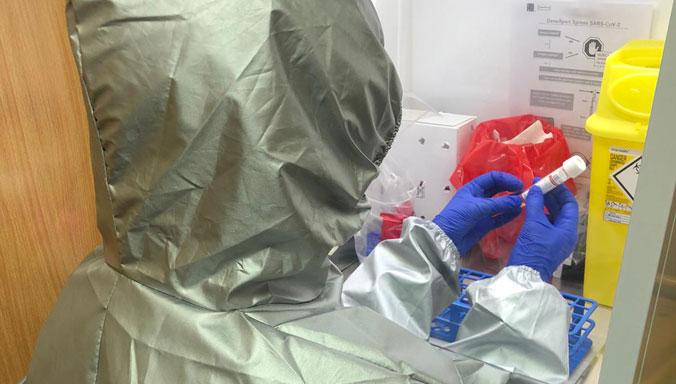 Covid-19 testing capacity of RS being upgraded