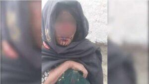 Man who chopped off wife’s nose arrested