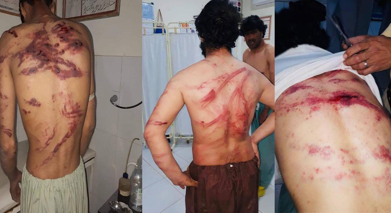 Afghan Migrants tortured in Iran