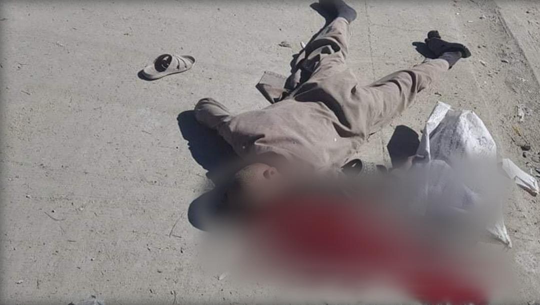 طفل کشته شده در شهر کابل