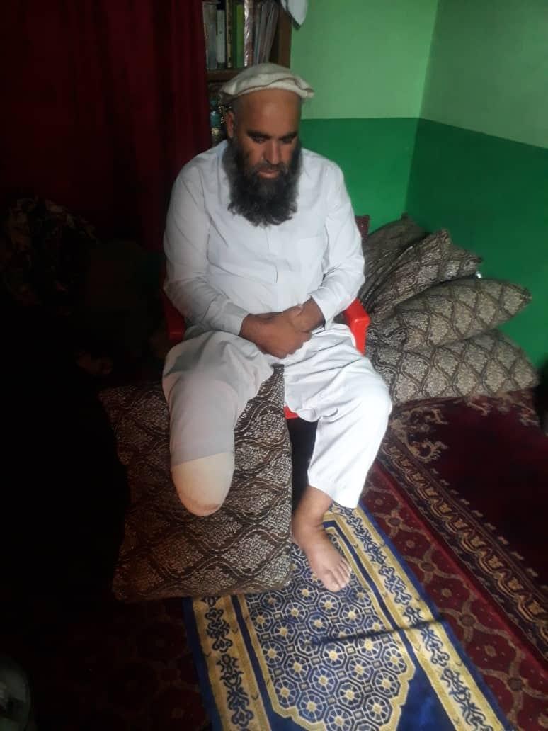 قطع شدن یک پای ملک قریه در پروان