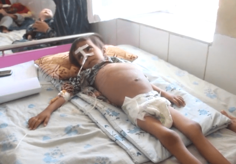 ‘Deadly’ sore throat disease emerges in Jawzjan
